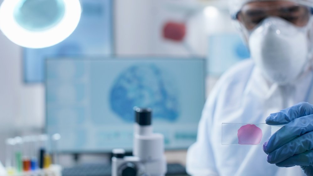 Tecnologia e ciência contra o câncer: novos exames genômicos ajudam a identificar propensão à doença